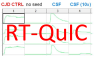 Positive RT-QuIC result